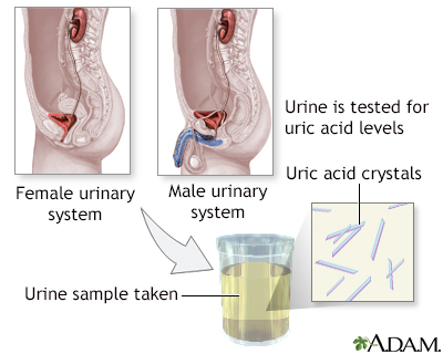 Uric acid test