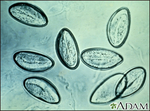 Pinworm eggs