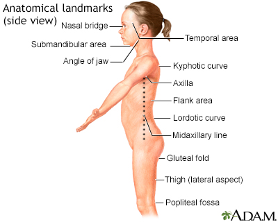 Flank pain