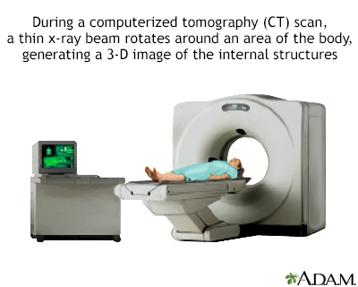 CT scan