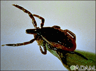 Tick, deer - adult female