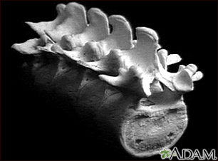 Vertebra, lumbar (low back)