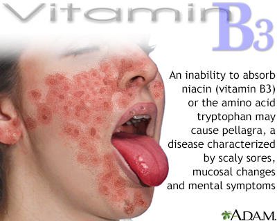 Vitamin B3 deficit