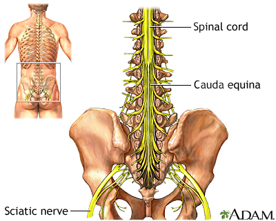 Cauda equina