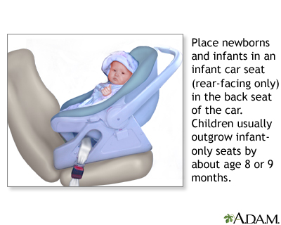 Rear-facing car seat