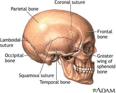 Brain tumor