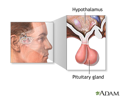 Transjugular intrahepatic portosystemic shunt