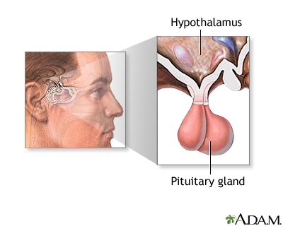 Transjugular intrahepatic portosystemic shunt