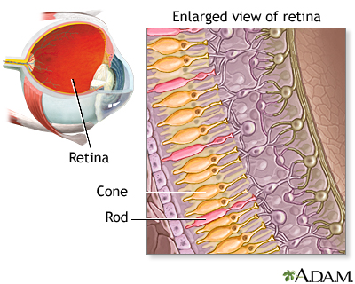 Central venous catheter