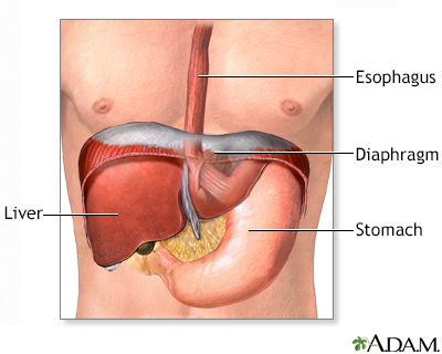 ECG electrode placement