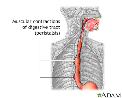 Double aortic arch