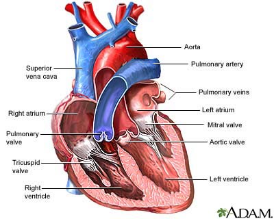 Vascular ring