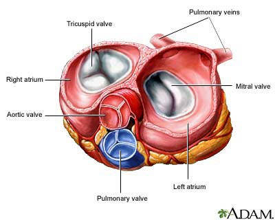 Pneumothorax