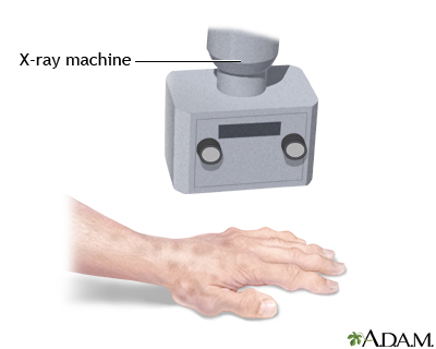 Normal rotator cuff