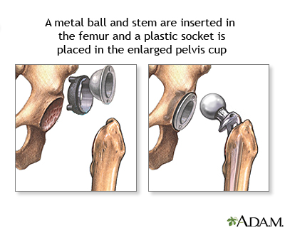 Anterior shoulder stretch