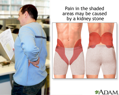 Kidney pain