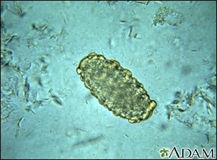 Ascaris lumbricoides egg