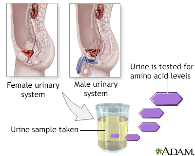 Aminoaciduria urine test