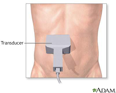 Abdominal ultrasound