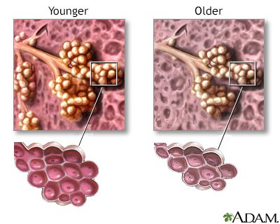 Changes in lung tissue with age