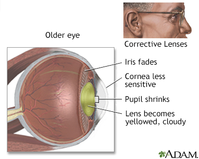 Aged eye anatomy