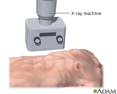 X-ray