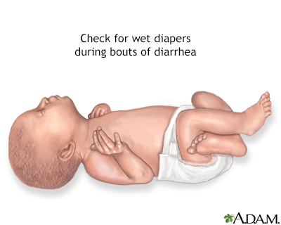 Diapers and diarrhea