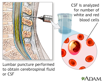 CSF cell count