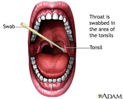 Throat swabs