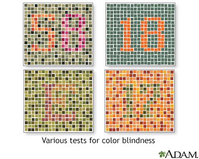 Color blindness tests