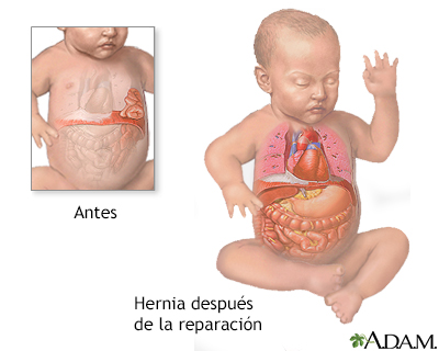 Cuidados postoperatorios