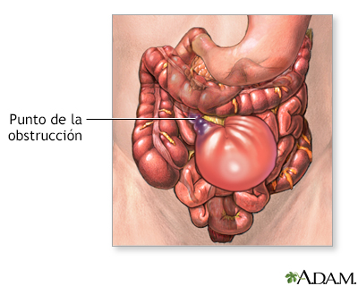 Indicaciones (primera parte)