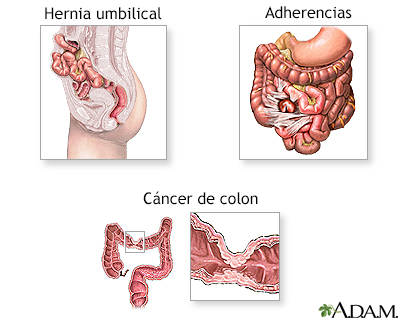 Indicaciones (segunda parte)