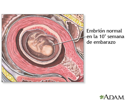  Embrión de 10 semanas
