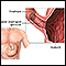 Achalasia - series