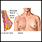 Breast augmentation - series - Normal anatomy